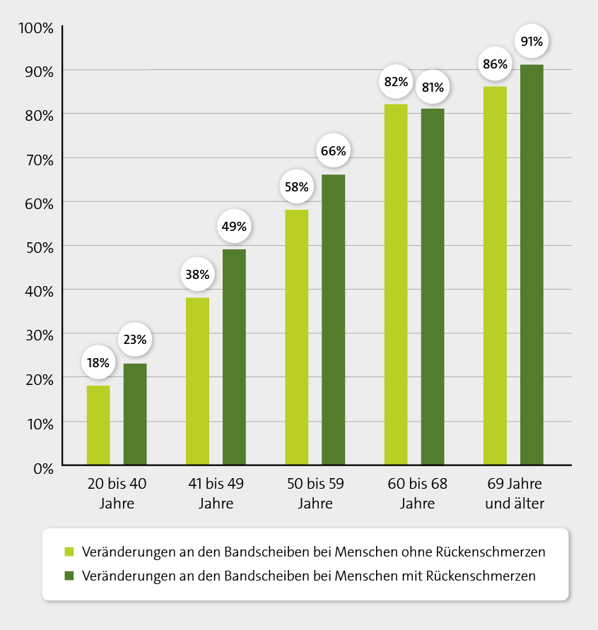 Das Säulendiagramm zeigt Veränderungen an den Bandscheiben bei Menschen mit im Vergleich zu ohne Rückenschmerzen in verschiedenen Altersgruppen in Prozent.